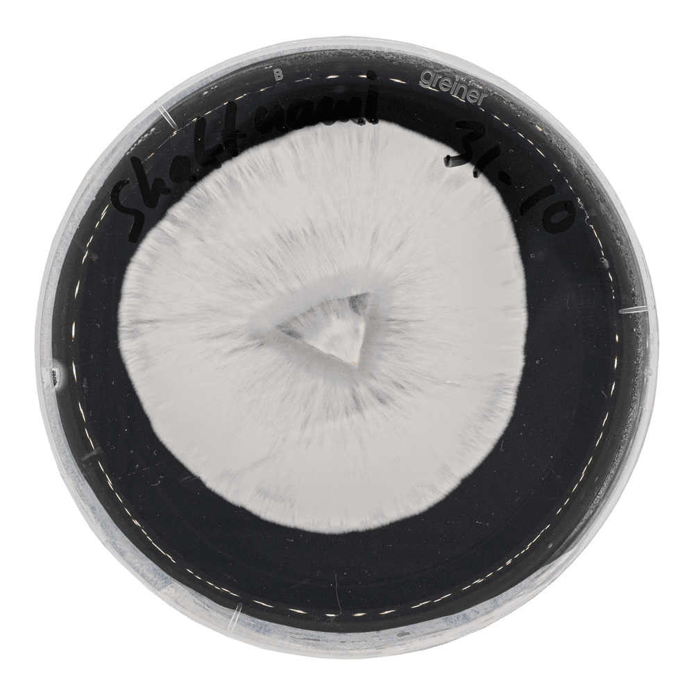 acid shroomz shaktnami culture on agar in petri dish